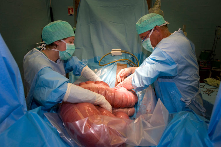 colic surgery