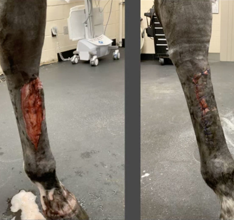bandaging before and after