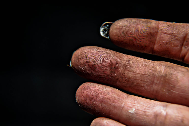 hands are fomites for carrying germs