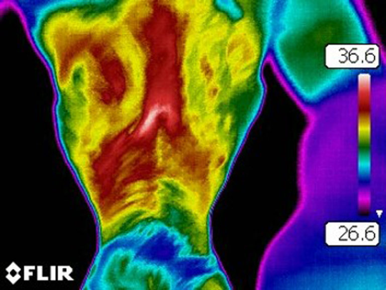 Thermography not normal Tennessee Walking Horse