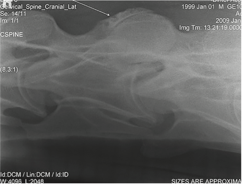 X-Rays help diagnose neck mobility issues in horses. This horse had significant osteolytic changes. 