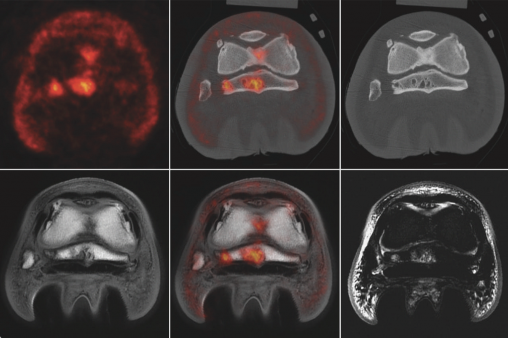 PET, CT and MRI distal limb imaging from a horse with navicular and middle phalanx lesions.