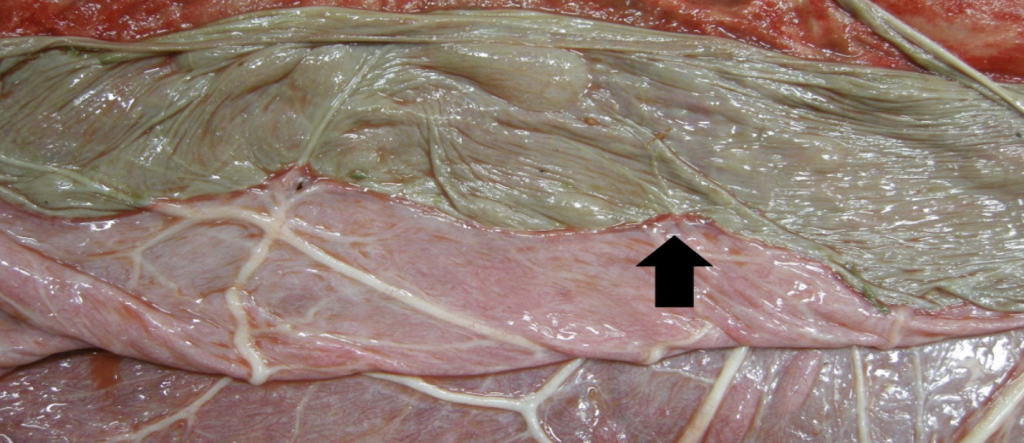 Figure 2. Allantoic surface of the allantochorion. A locally extensive and well demarcated region of the allantochorion is tannish-green and necrotic. A red, raised line (black arrow) separates the dead region of the placenta from the pink viable tissue.