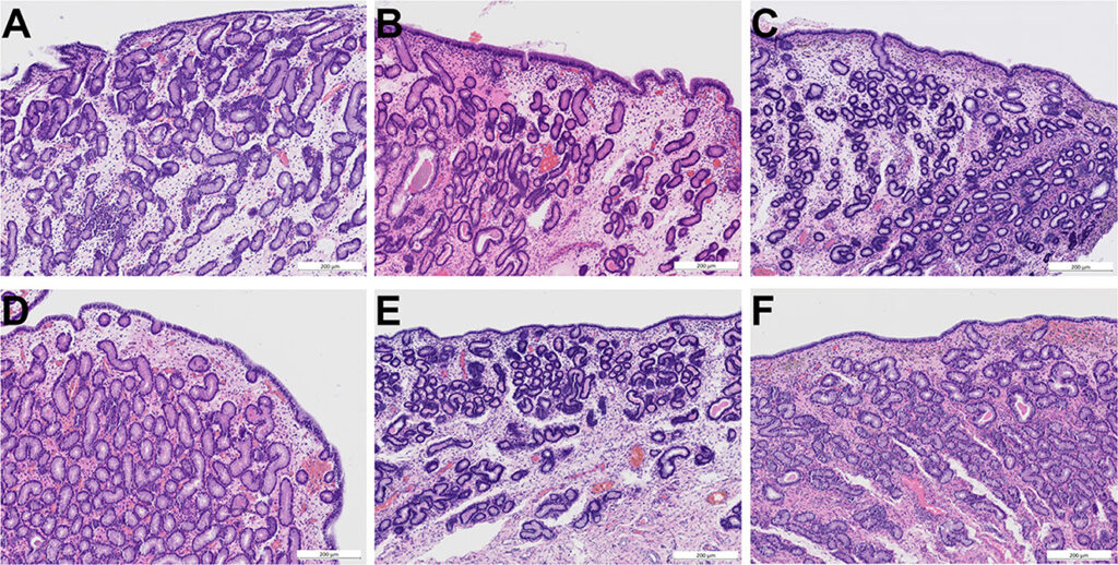 Photomicrographs of endometrial biopsies in horses obtained before and after ozone treatment. 