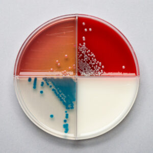 Uterine Culture and Cytology