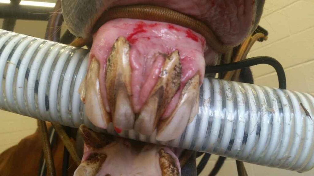 A severe case of EOTRH