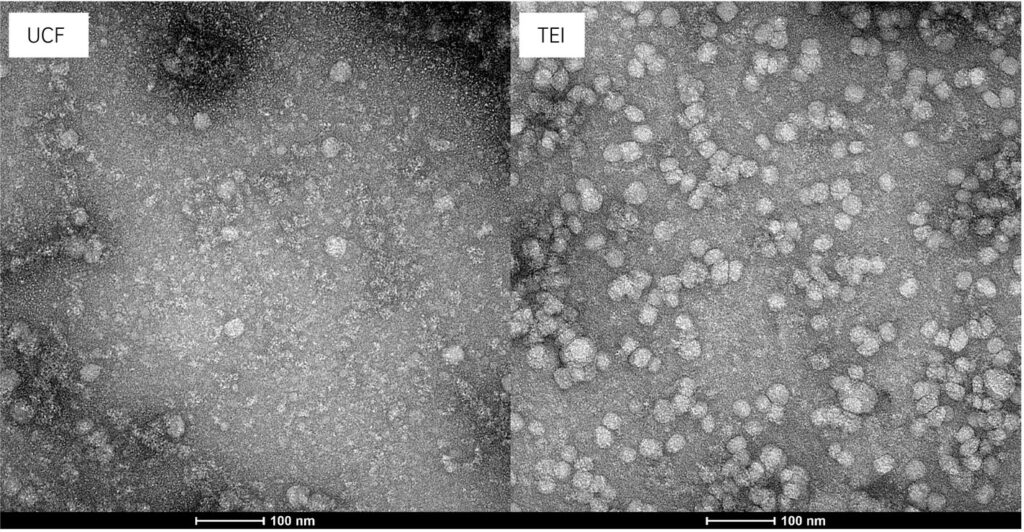 Representative negative-stained transmission electron microphotographs of BM-EVs isolated via ultracentrifugation (UCF) and precipitation (Total Exosome Isolation reagent, TEI) methods. 