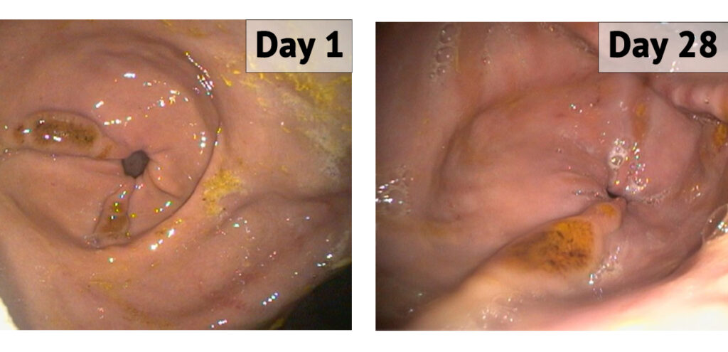 Equine gastric ulcers on gastroscopy exam