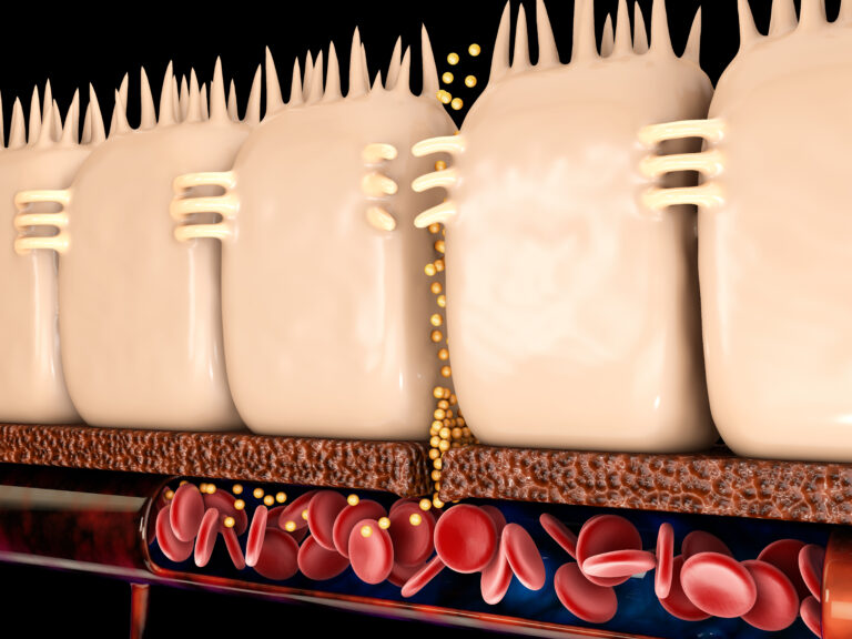 3d Rendering of leaky gut, in intestine with celiac disease and gluten sensitivity these tight junctions come apart