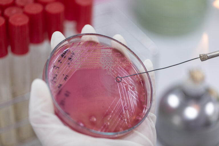 Streak plate for Bacteria culture or identify Bacteria research in labmicrology