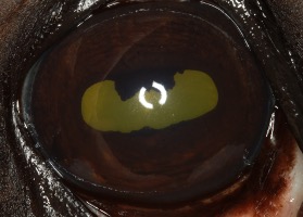 Uveitis