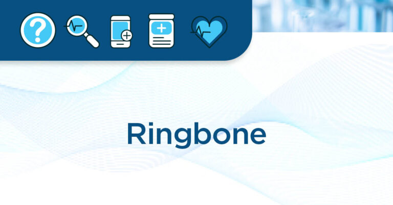 EM Fact Sheet article page header-1200x628-ringbone
