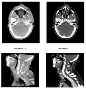 Human head axial and head and neck sagittal CT image comparison.  

Adapted from Lechuga and Weidlich (Ref 4)