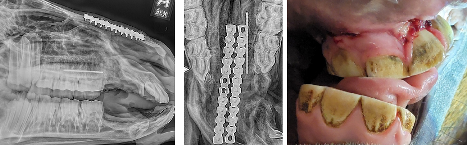 Post-op radiographs with nasal plates and pin remaining, final results. 