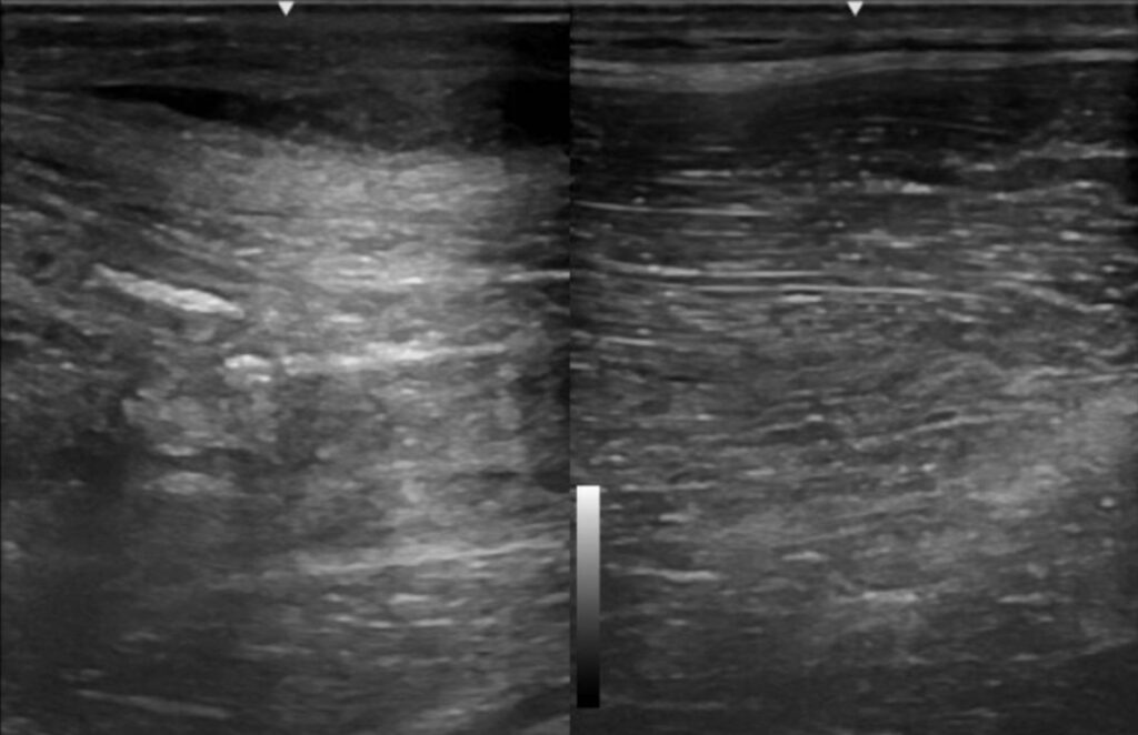 Ultrasound of a horse's swelling
