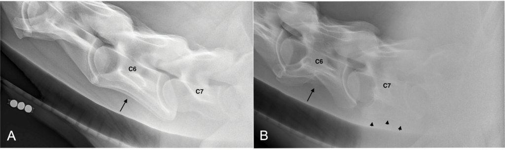 Transposition of ventral lamina of C6 onto C7. Figure A shows a normal distal cervical vertebral column and B shows a morphological variation whereby the ventral lamina are bilaterally and completely absent from C6 and instead found on C7. Arrows are directed at the ventral lamina in panel A and at the absence thereof in panel B. Arrowheads in panel B are directed at the lamina on C7.